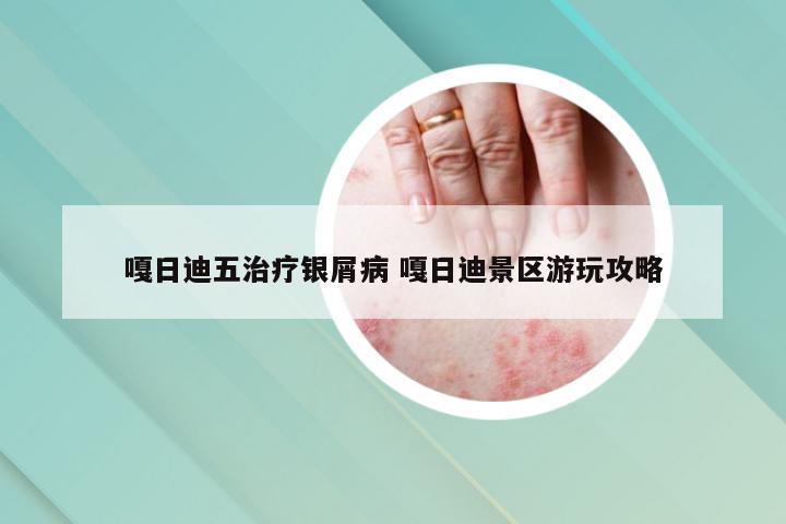嘎日迪五治疗银屑病 嘎日迪景区游玩攻略