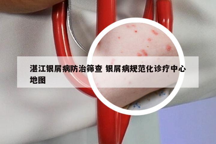 湛江银屑病防治筛查 银屑病规范化诊疗中心地图