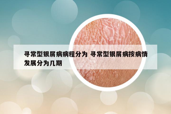 寻常型银屑病病程分为 寻常型银屑病按病情发展分为几期