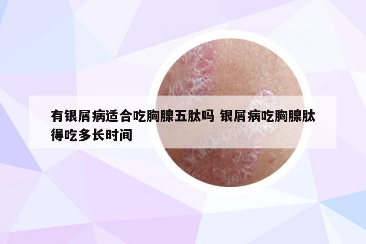 有银屑病适合吃胸腺五肽吗 银屑病吃胸腺肽得吃多长时间