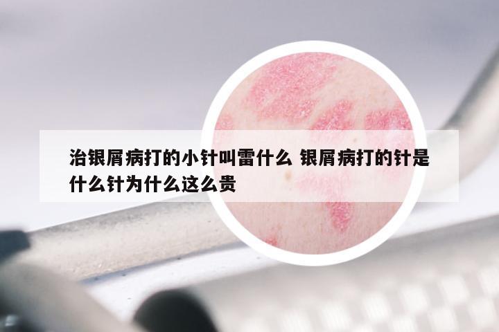 治银屑病打的小针叫雷什么 银屑病打的针是什么针为什么这么贵