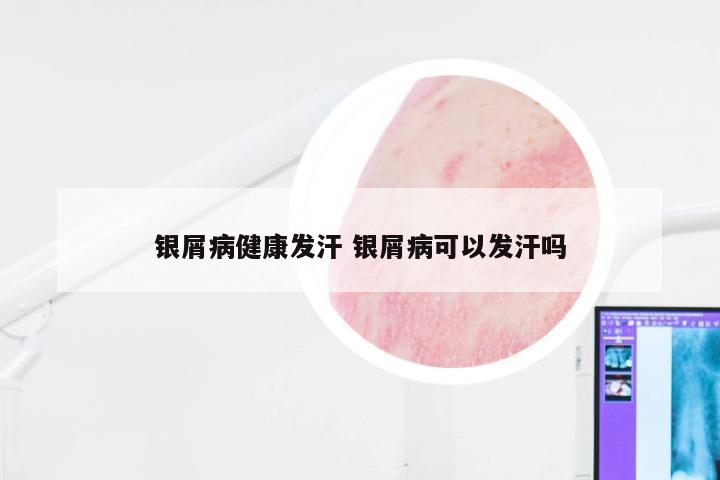 银屑病健康发汗 银屑病可以发汗吗