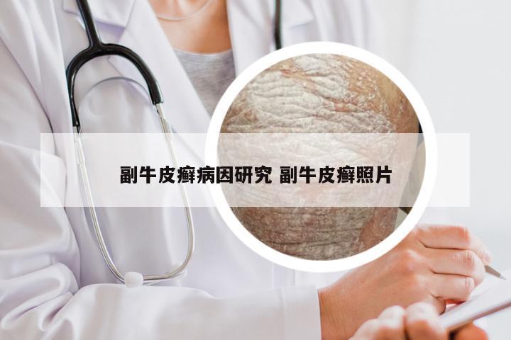 副牛皮癣病因研究 副牛皮癣照片