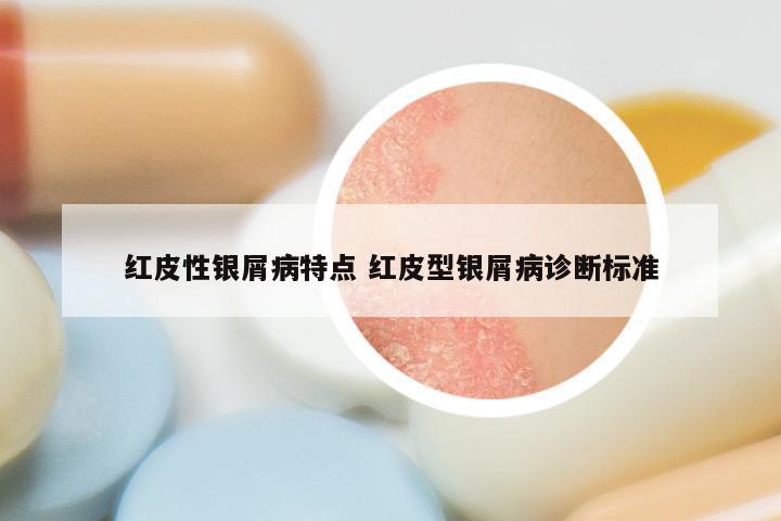 红皮性银屑病特点 红皮型银屑病诊断标准