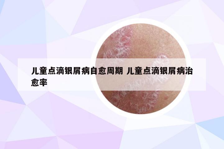 儿童点滴银屑病自愈周期 儿童点滴银屑病治愈率