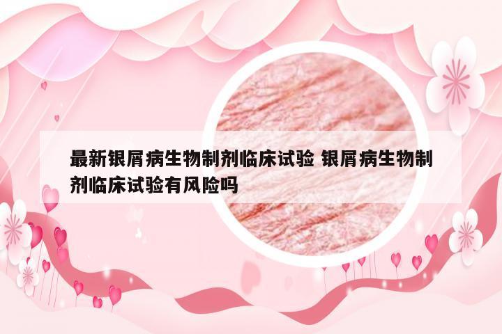 最新银屑病生物制剂临床试验 银屑病生物制剂临床试验有风险吗