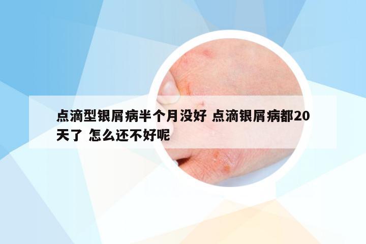 点滴型银屑病半个月没好 点滴银屑病都20天了 怎么还不好呢
