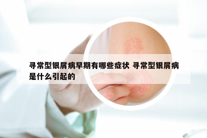 寻常型银屑病早期有哪些症状 寻常型银屑病是什么引起的