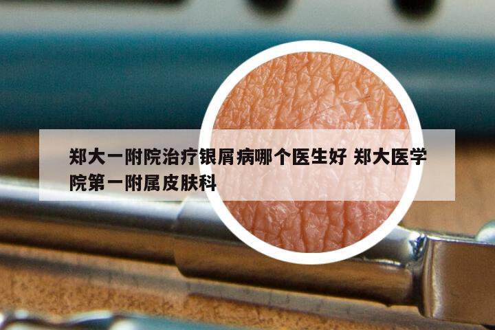 郑大一附院治疗银屑病哪个医生好 郑大医学院第一附属皮肤科