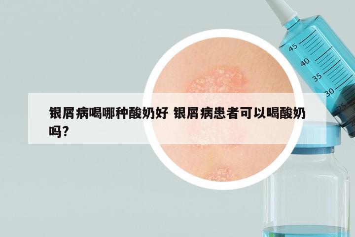 银屑病喝哪种酸奶好 银屑病患者可以喝酸奶吗?