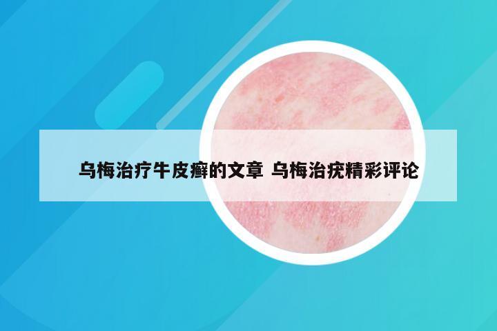 乌梅治疗牛皮癣的文章 乌梅治疣精彩评论