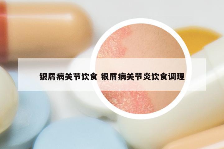 银屑病关节饮食 银屑病关节炎饮食调理