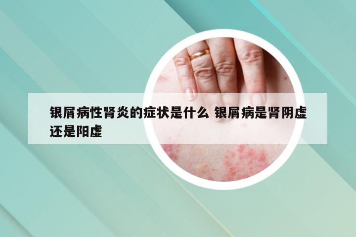 银屑病性肾炎的症状是什么 银屑病是肾阴虚还是阳虚