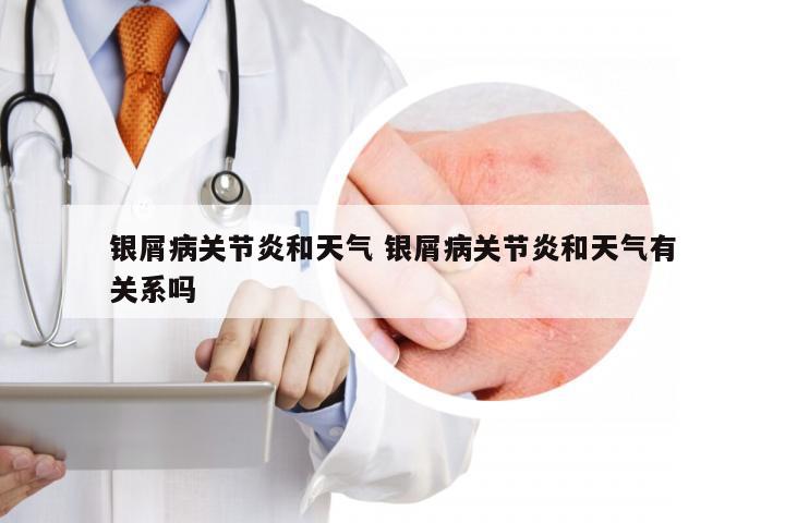 银屑病关节炎和天气 银屑病关节炎和天气有关系吗
