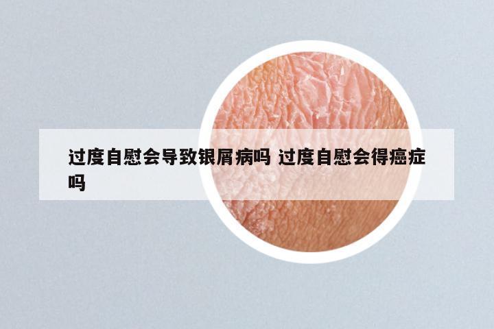 过度自慰会导致银屑病吗 过度自慰会得癌症吗