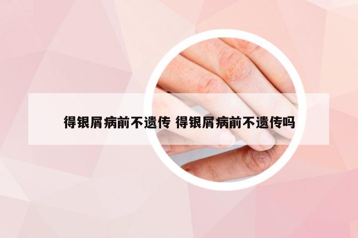 得银屑病前不遗传 得银屑病前不遗传吗