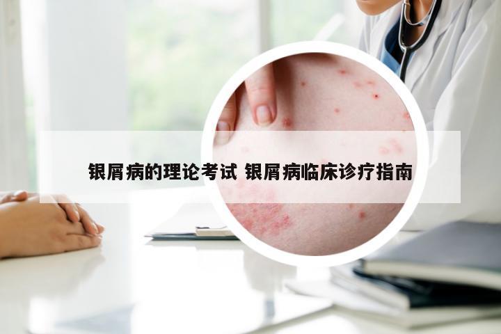银屑病的理论考试 银屑病临床诊疗指南