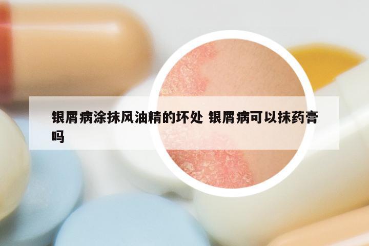 银屑病涂抹风油精的坏处 银屑病可以抹药膏吗