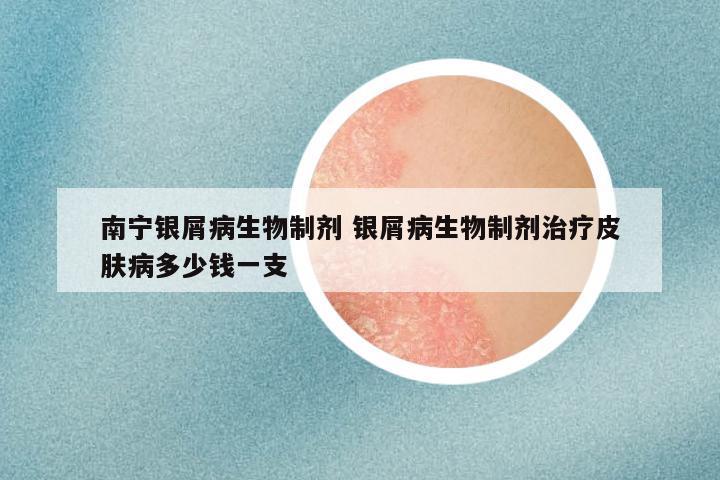 南宁银屑病生物制剂 银屑病生物制剂治疗皮肤病多少钱一支