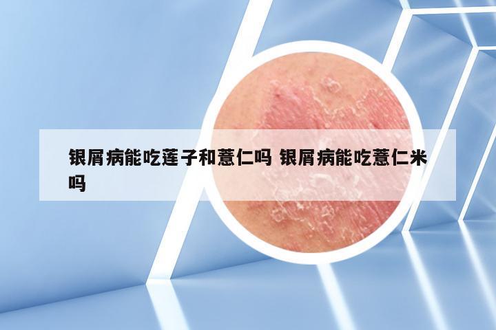 银屑病能吃莲子和薏仁吗 银屑病能吃薏仁米吗