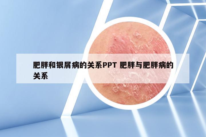 肥胖和银屑病的关系PPT 肥胖与肥胖病的关系