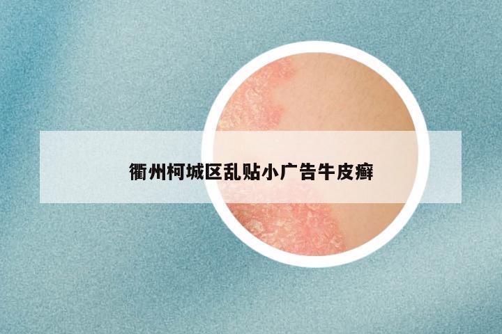 衢州柯城区乱贴小广告牛皮癣