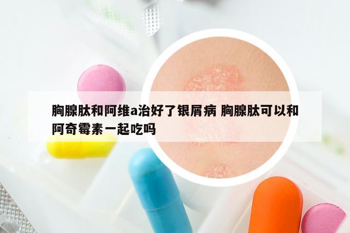 胸腺肽和阿维a治好了银屑病 胸腺肽可以和阿奇霉素一起吃吗