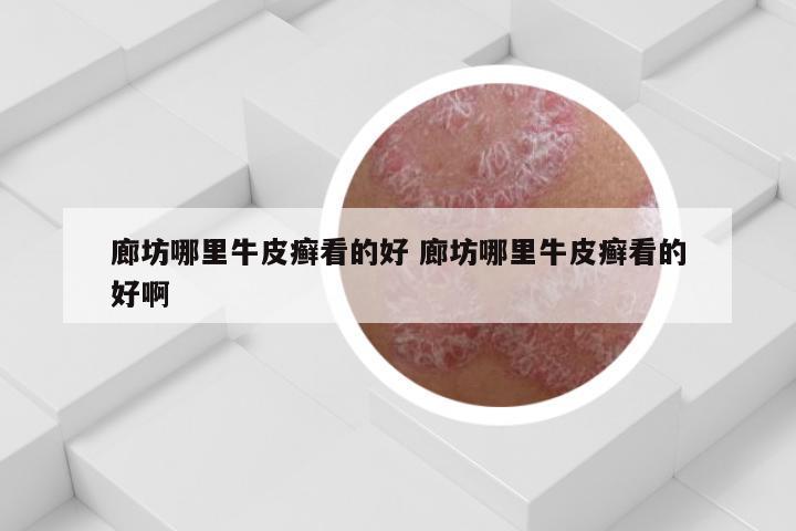 廊坊哪里牛皮癣看的好 廊坊哪里牛皮癣看的好啊