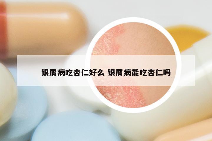 银屑病吃杏仁好么 银屑病能吃杏仁吗