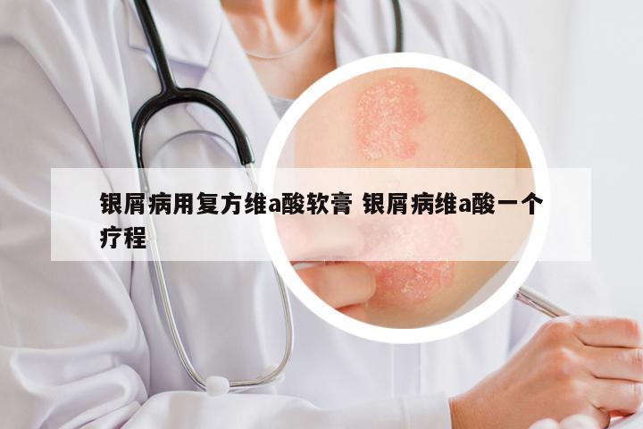 银屑病用复方维a酸软膏 银屑病维a酸一个疗程
