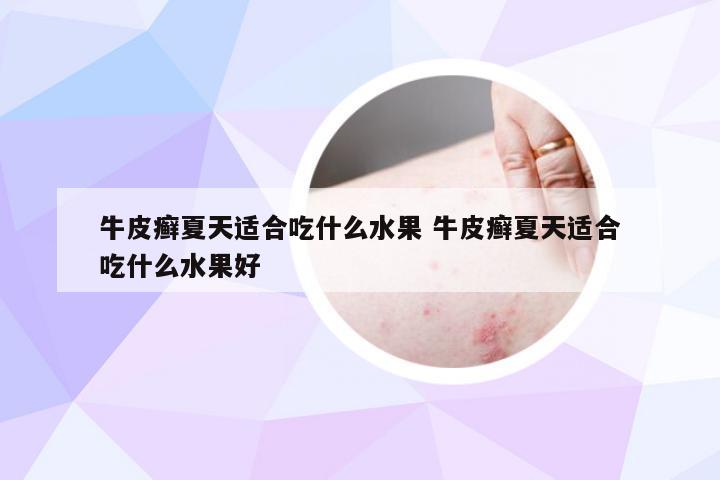 牛皮癣夏天适合吃什么水果 牛皮癣夏天适合吃什么水果好