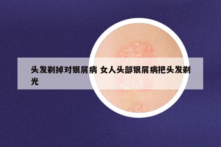 头发剃掉对银屑病 女人头部银屑病把头发剃光