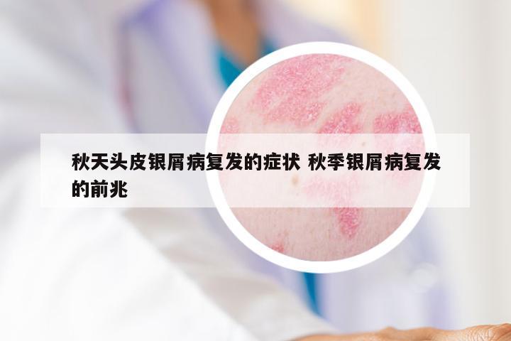秋天头皮银屑病复发的症状 秋季银屑病复发的前兆