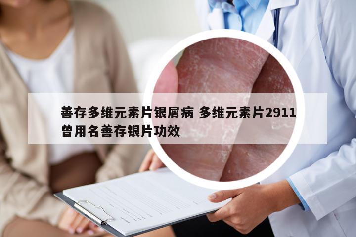 善存多维元素片银屑病 多维元素片2911曾用名善存银片功效