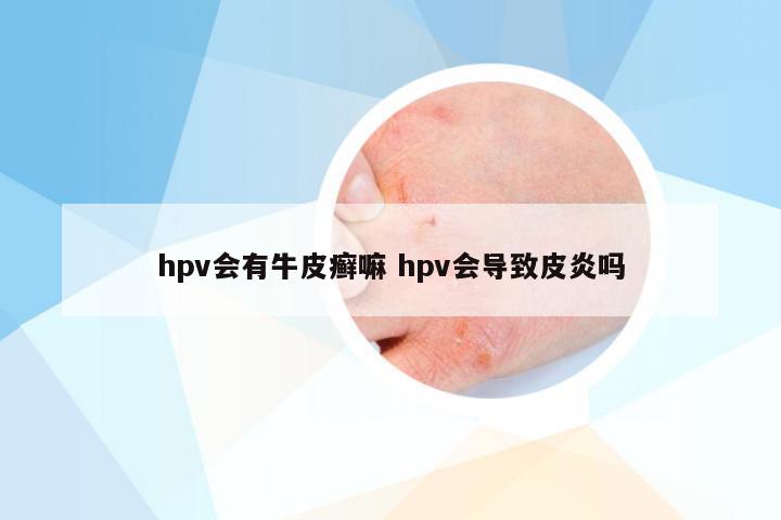 hpv会有牛皮癣嘛 hpv会导致皮炎吗