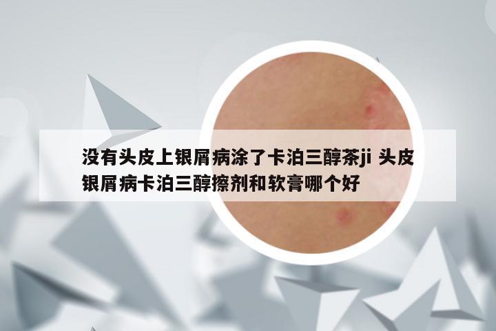 没有头皮上银屑病涂了卡泊三醇茶ji 头皮银屑病卡泊三醇擦剂和软膏哪个好