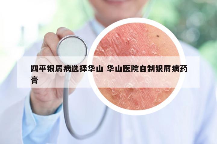 四平银屑病选择华山 华山医院自制银屑病药膏