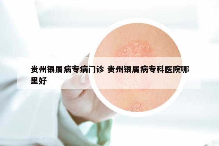 贵州银屑病专病门诊 贵州银屑病专科医院哪里好