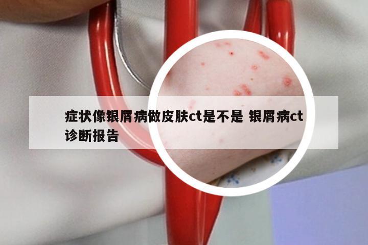 症状像银屑病做皮肤ct是不是 银屑病ct诊断报告