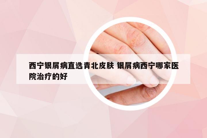西宁银屑病直选青北皮肤 银屑病西宁哪家医院治疗的好