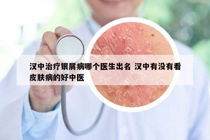 汉中治疗银屑病哪个医生出名 汉中有没有看皮肤病的好中医