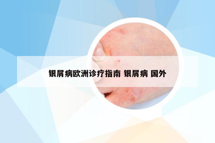 银屑病欧洲诊疗指南 银屑病 国外
