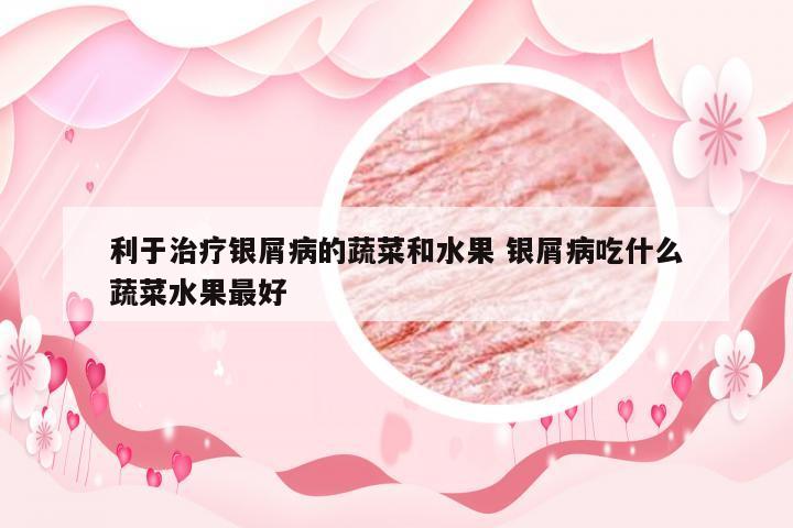利于治疗银屑病的蔬菜和水果 银屑病吃什么蔬菜水果最好