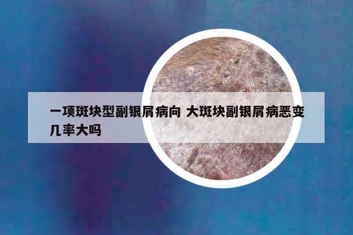 一项斑块型副银屑病向 大斑块副银屑病恶变几率大吗