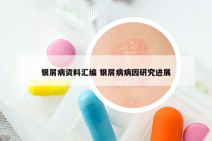 银屑病资料汇编 银屑病病因研究进展