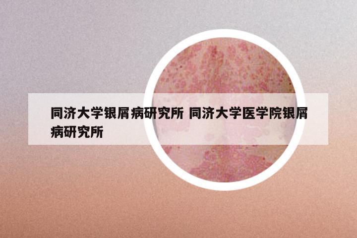 同济大学银屑病研究所 同济大学医学院银屑病研究所
