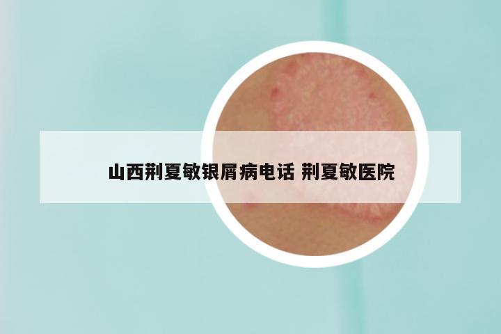山西荆夏敏银屑病电话 荆夏敏医院