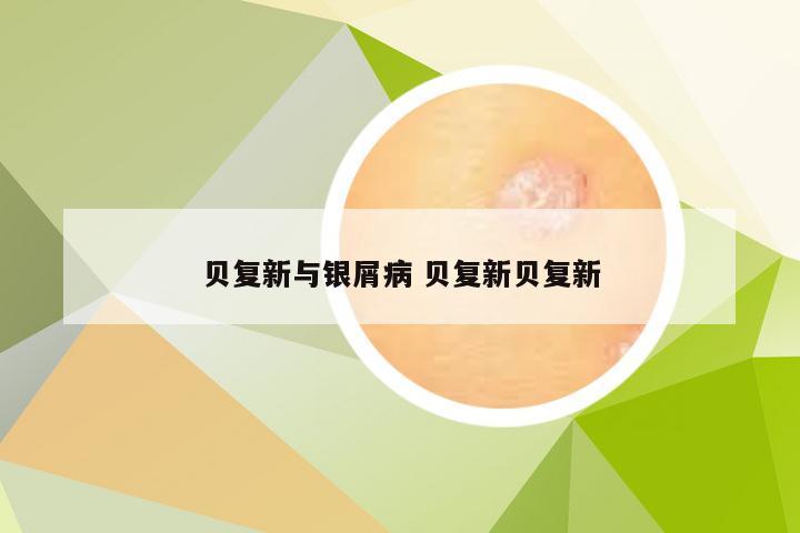 贝复新与银屑病 贝复新贝复新