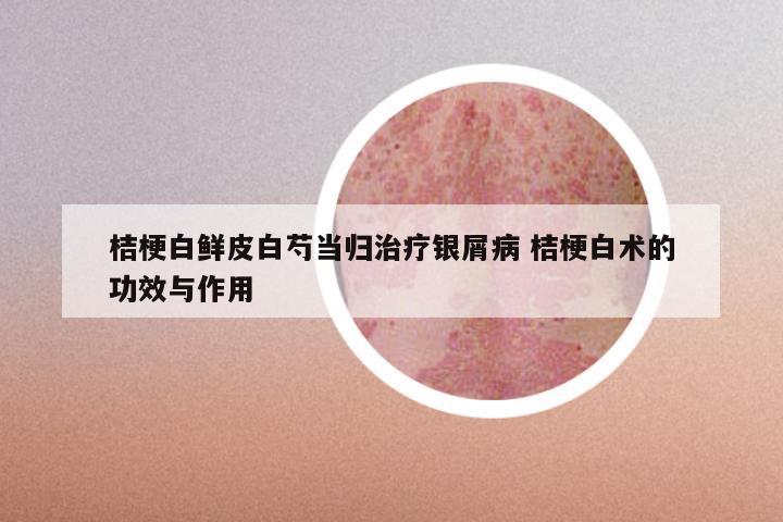 桔梗白鲜皮白芍当归治疗银屑病 桔梗白术的功效与作用