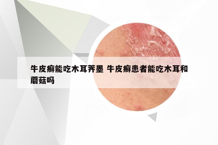 牛皮癣能吃木耳荠墨 牛皮癣患者能吃木耳和蘑菇吗